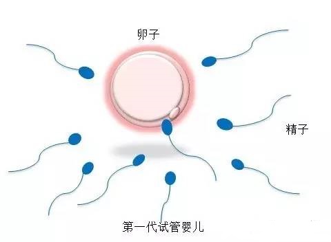 关于试管代怀包生捐卵公司